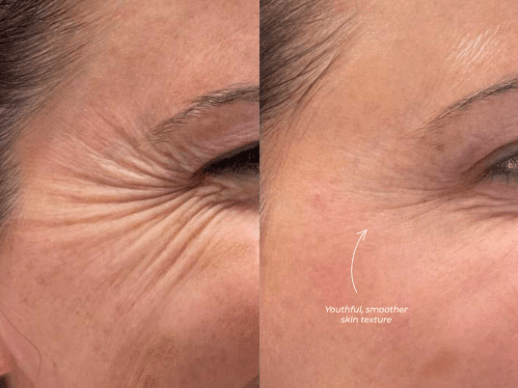 Ageless Truffle Creme - LUXLASHES