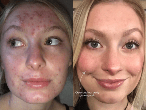 Ageless Truffle Creme - LUXLASHES